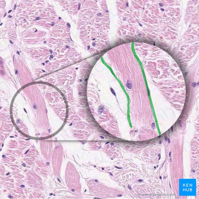 Sarcolema (Sarcolemma); Imagen: 