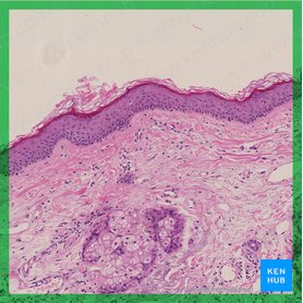 Integumentary system: Definition, diagram and function | Kenhub