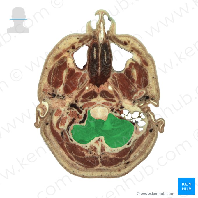 Cerebelo (Cerebellum); Imagem: National Library of Medicine