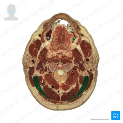 Splenius capitis muscle (Musculus splenius capitis); Image: National Library of Medicine