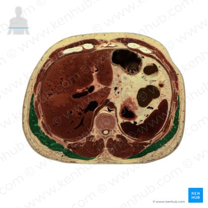 Musculus latissimus dorsi (Breiter Rückenmuskel); Bild: National Library of Medicine