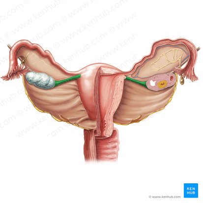 Ligamento propio del ovario (Ligamentum proprium ovarii); Imagen: Samantha Zimmerman