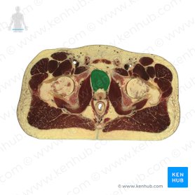 Urinary bladder (Vesica urinaria); Image: National Library of Medicine