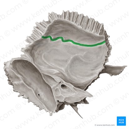 Surco para la arteria meníngea media del hueso temporal (Sulcus arteriae meningeae mediae ossis temporalis); Imagen: Samantha Zimmerman