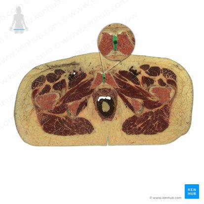 Symphysis pubica (Schambeinfuge); Bild: National Library of Medicine
