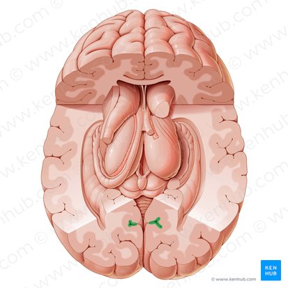 Calcarine sulcus (Sulcus calcarinus); Image: Paul Kim