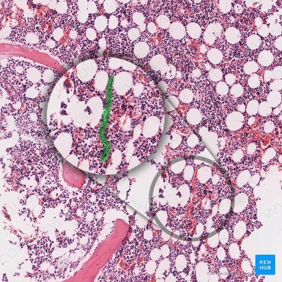 Sinusoidal capillary (Vas sinusoideum); Image: 