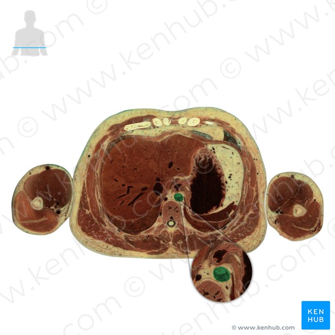 Aorta descendente torácica (Aorta thoracica descendens); Imagem: National Library of Medicine