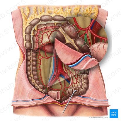 Anterior cecal artery (Arteria caecalis anterior); Image: Irina Münstermann