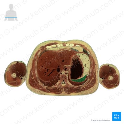 Baço (Splen); Imagem: National Library of Medicine