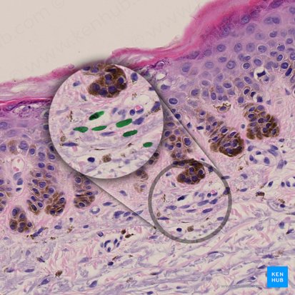 Fibroblastus (Fibroblast); Bild: 