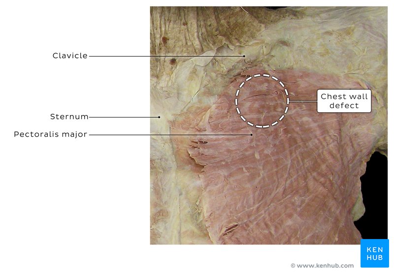 Chest region - cadaveric image