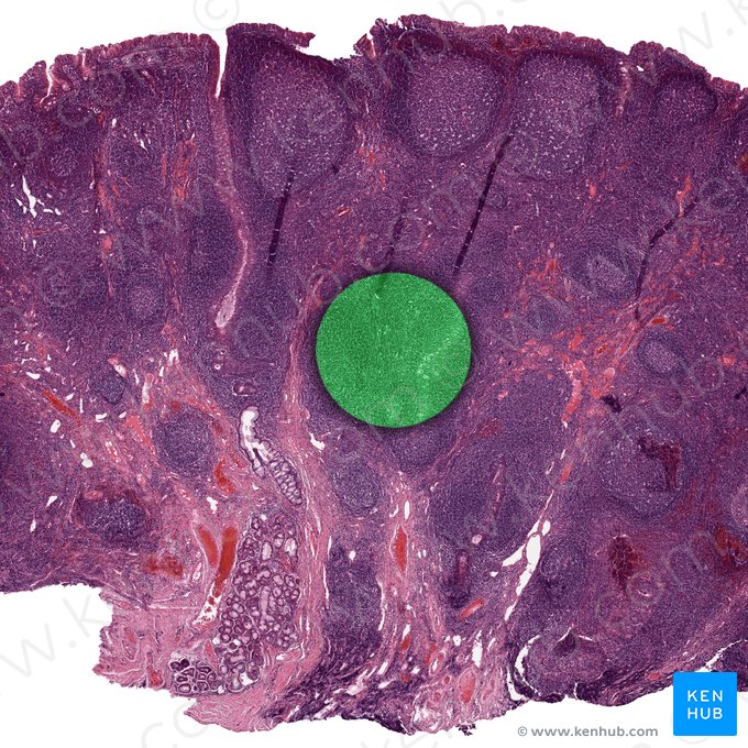 Tecido conjuntivo reticular; Imagem: 