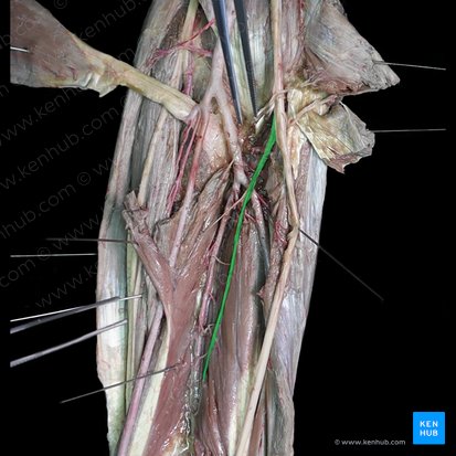 Nervo interósseo anterior (Nervus interosseous anterior); Imagem: 