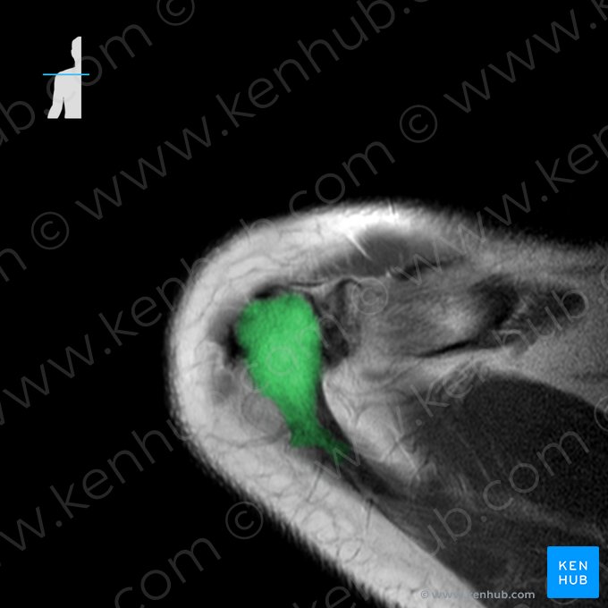 Acromion de la escápula (Acromion scapulae); Imagen: 