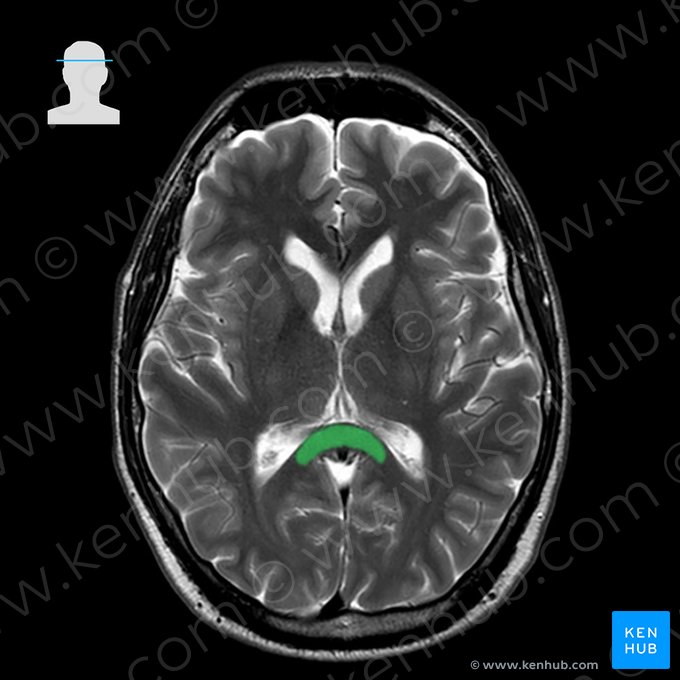 Splenium of corpus callosum (Splenium corporis callosi); Image: 