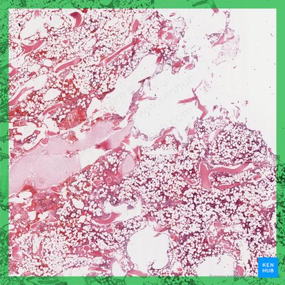 Medula óssea amarela (Medulla ossium flava); Imagem: 