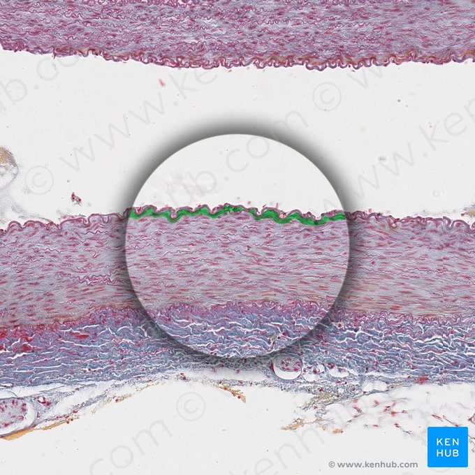 Subendothelium (Stratum subendotheliale); Image: 