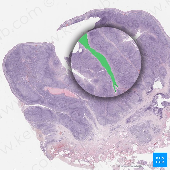 Crypt of lingual tonsil (Crypta tonsillae lingualis); Image: 