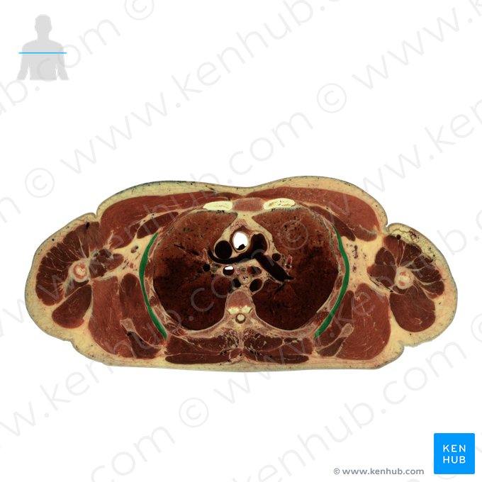 Músculo serrátil anterior (Musculus serratus anterior); Imagem: National Library of Medicine