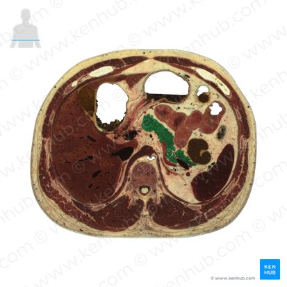 Pancréas (Pancreas); Image : National Library of Medicine