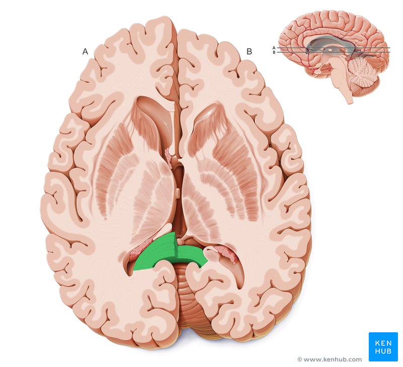 Splenium of corpus callosum - cross-sectional view