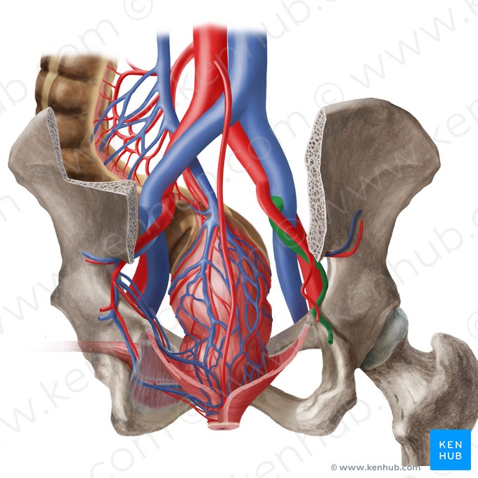 Vena ilíaca interna derecha (Vena iliaca interna dextra); Imagen: Begoña Rodriguez