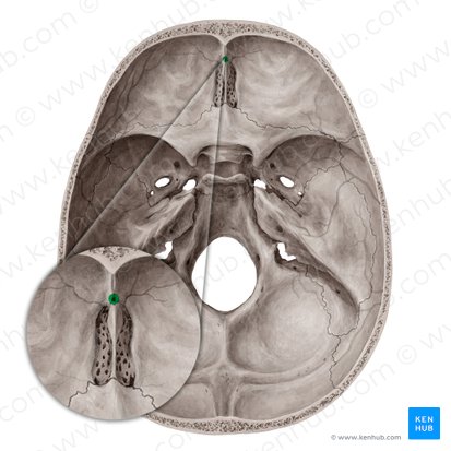 Forame cego do osso frontal (Foramen caecum ossis frontalis); Imagem: Yousun Koh