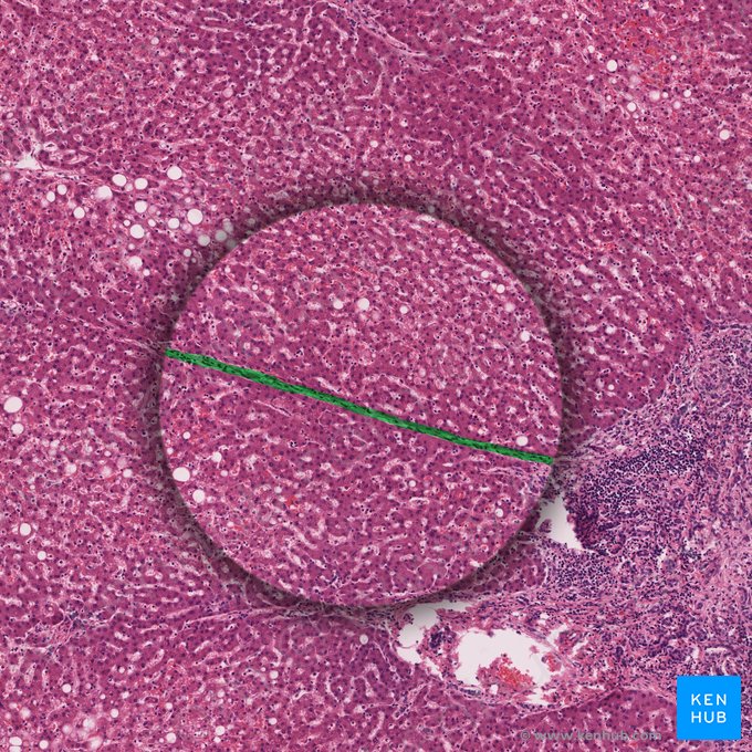 Tabique interlobulillar (Septum interlobularis); Imagen: 