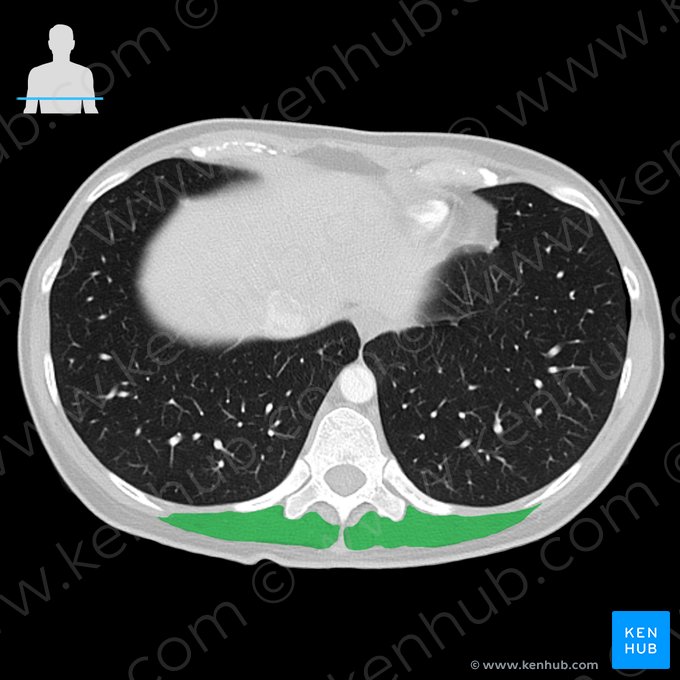 Erector spinae muscle (Musculus erector spinae); Image: 