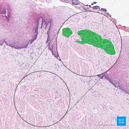 Musculus longitudinalis superior linguae (Oberer Längsmuskel der Zunge); Bild: 