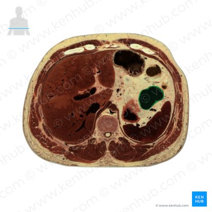 Descending colon (Colon descendens); Image: National Library of Medicine