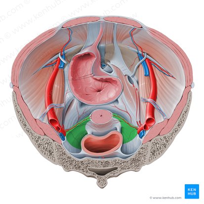 Ligamento cardinal (Ligamentum cardinale); Imagen: Paul Kim