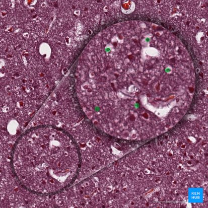 Células gliais (Neuroglia); Imagem: 