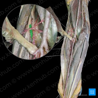 Rameau profond du nerf radial (Ramus profundus nervi radialis); Image : 
