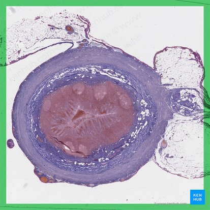 Vermiform appendix (Appendix vermiformis); Image: 