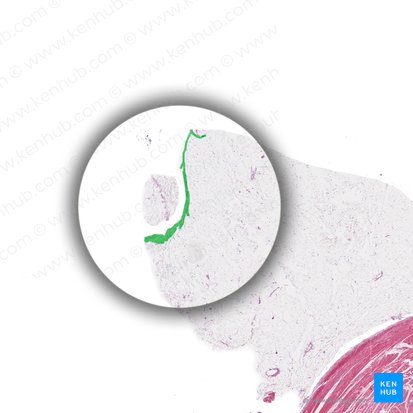 Mesothelium (Mesothel); Bild: 