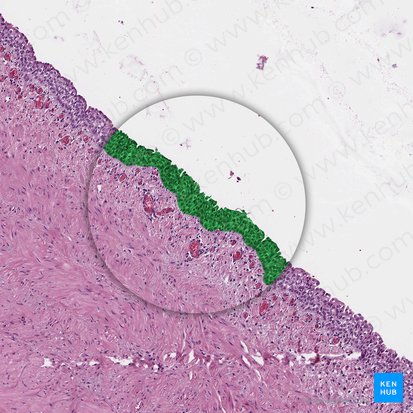 Urotélio (Urothelium); Imagen: 