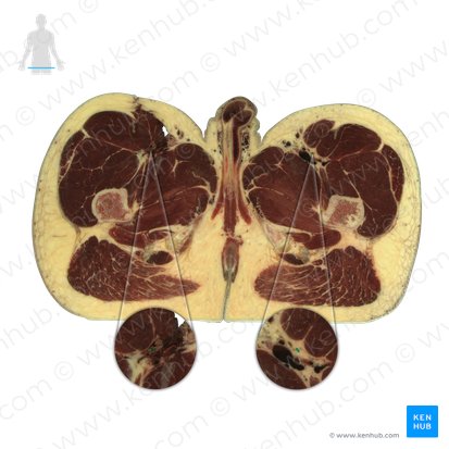 Nervus femoralis (Oberschenkelnerv); Bild: National Library of Medicine