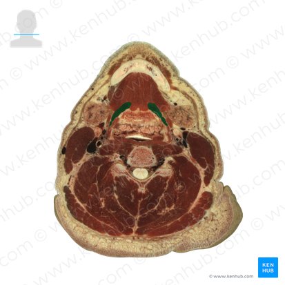 Musculus hyoglossus (Zungenbein-Zungen-Muskel); Bild: National Library of Medicine