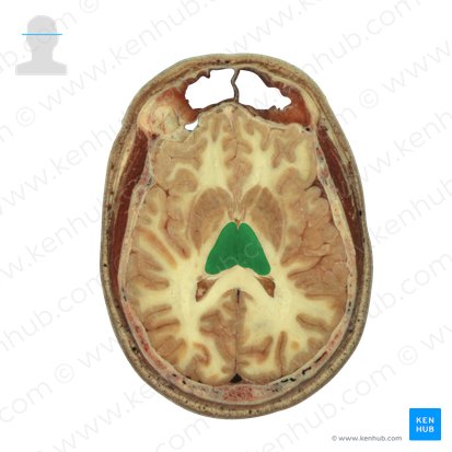 Thalamus; Image: National Library of Medicine