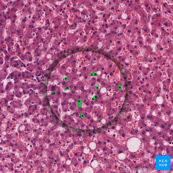 Células estrelladas hepáticas (Cellula perisinusoidalis); Imagen: 