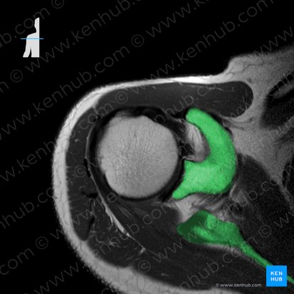 Escápula (Scapula); Imagen: 