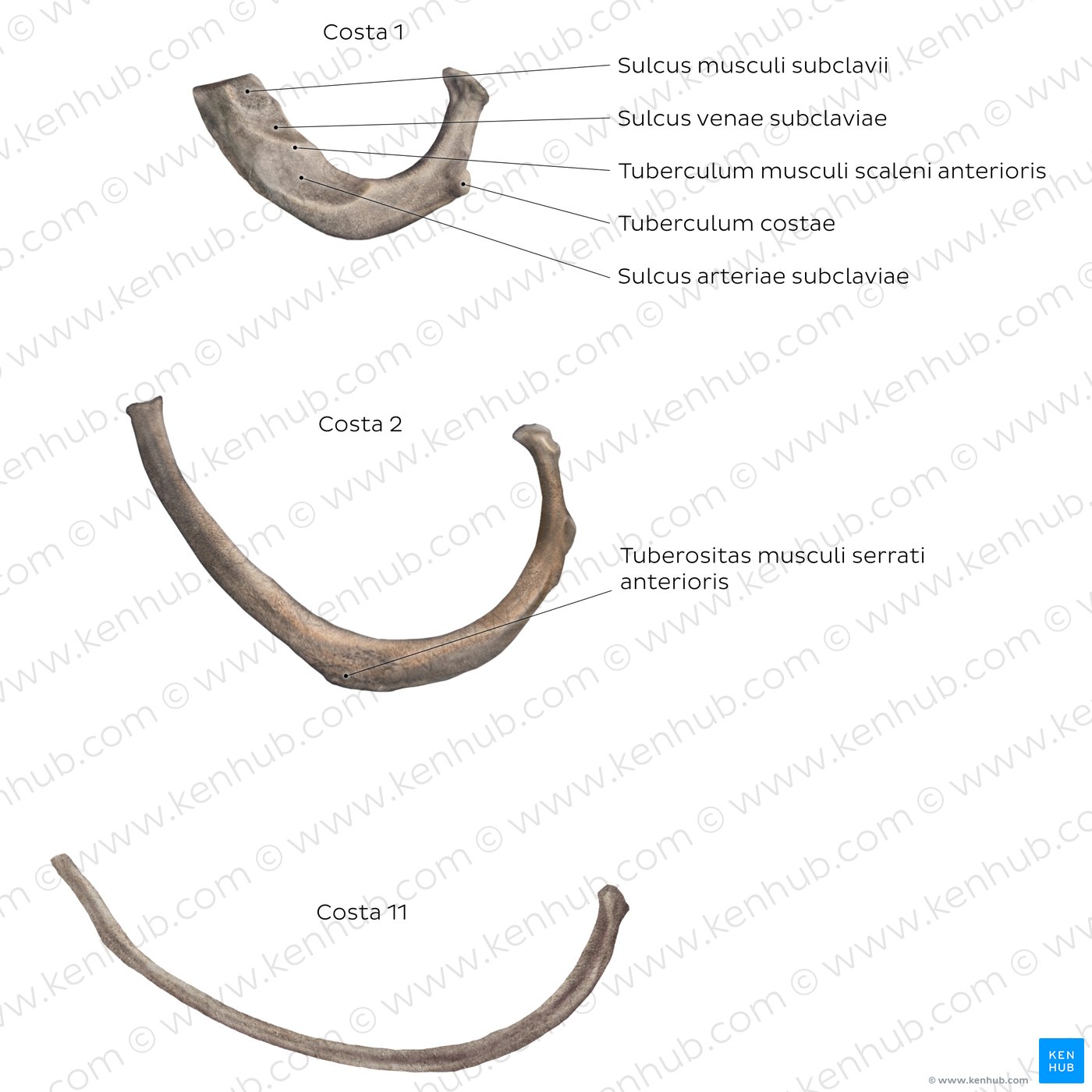 Costae atypicae