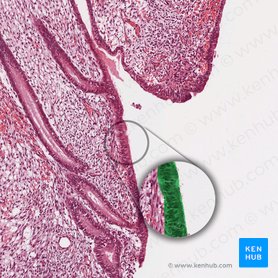 Epitelio cilíndrico simple del endometrio; Imagen: 
