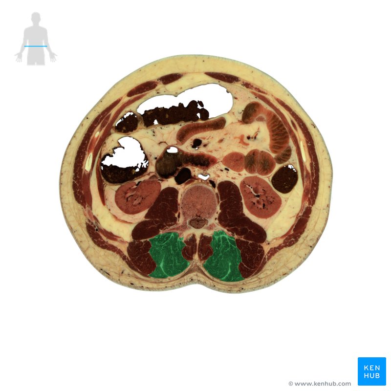 Longissimus muscle - axial view