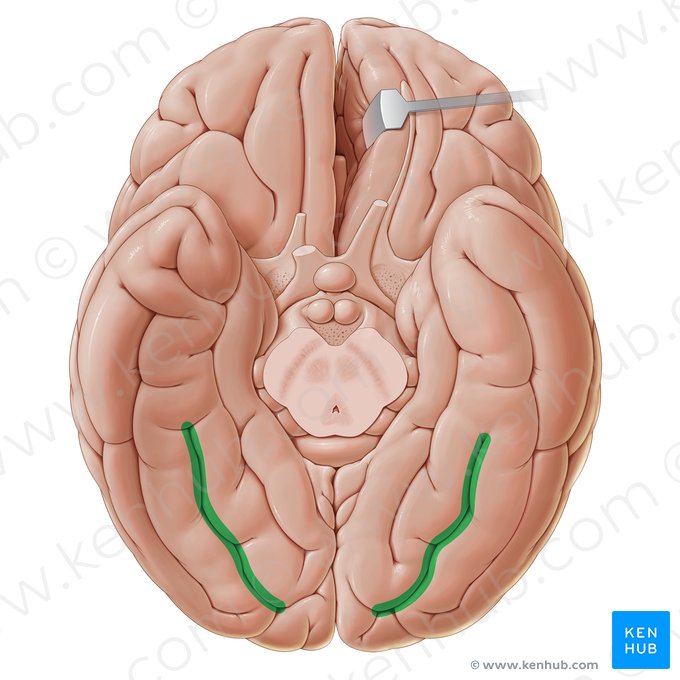 Sulco médio-fusiforme (Sulcus sagittalis gyri fusiformis); Imagem: Paul Kim