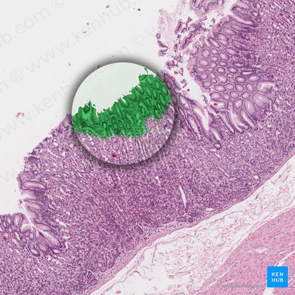 Epitelio foveolar (Epithelia foveolae gastricae); Imagen: 