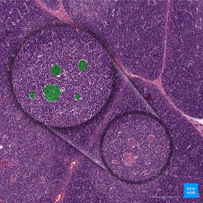 Corpúsculo tímico (Cospusculum thymicum); Imagen: 