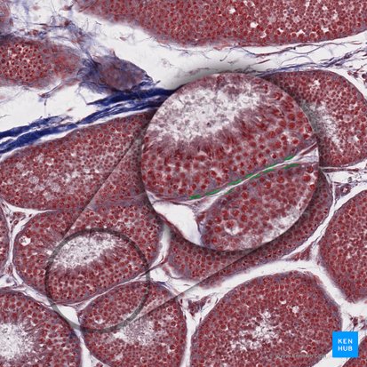 Peritubular myoid cell (Cellula myoidea peritubularis); Image: 